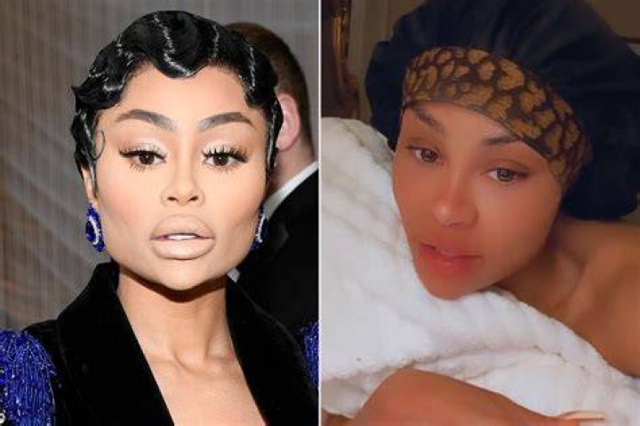Blac Chyna Removes 'Demonology' Tattoo After Dissolving Facial Filler
